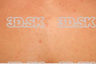 Skin texture of Lukas 0001